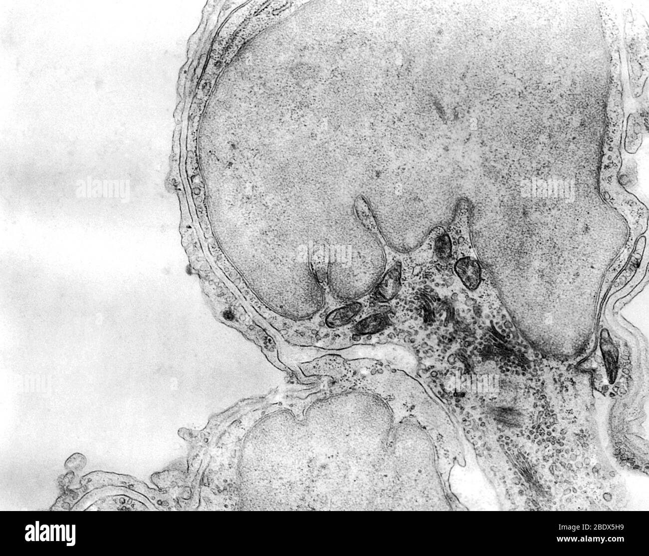 Micrograph lung alveoli alveolar hi-res stock photography and images ...