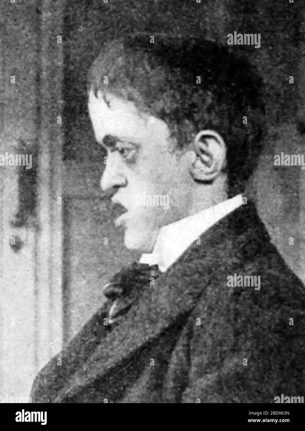 Acromegaly, 1898 Stock Photo