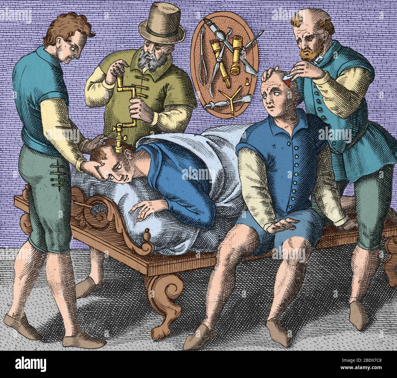 Trepanning Being Performed, 1594 Stock Photo