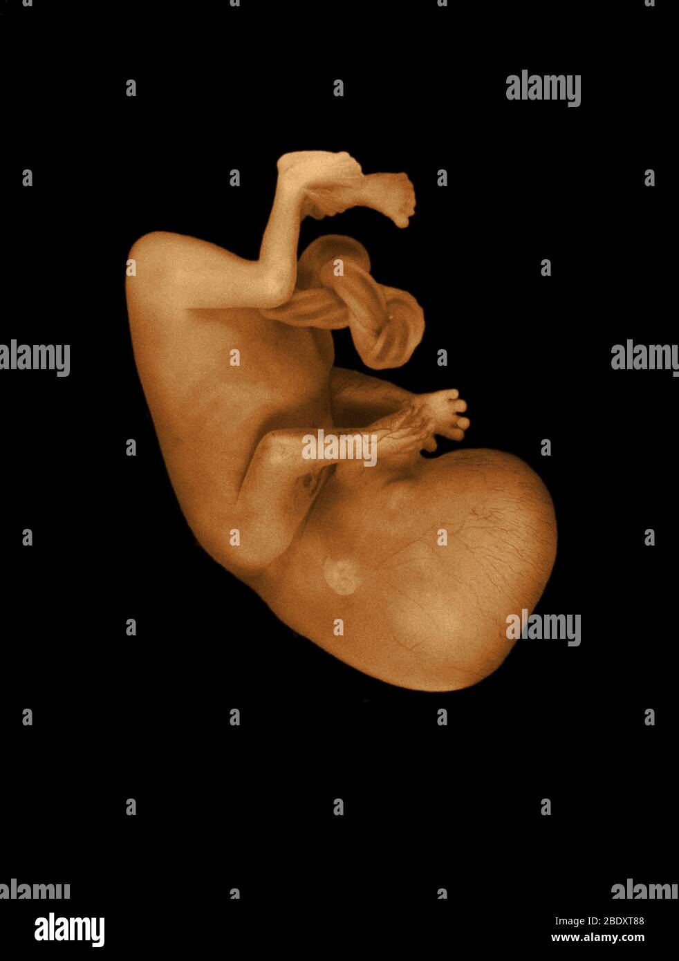 13 week old human fetus Stock Photo