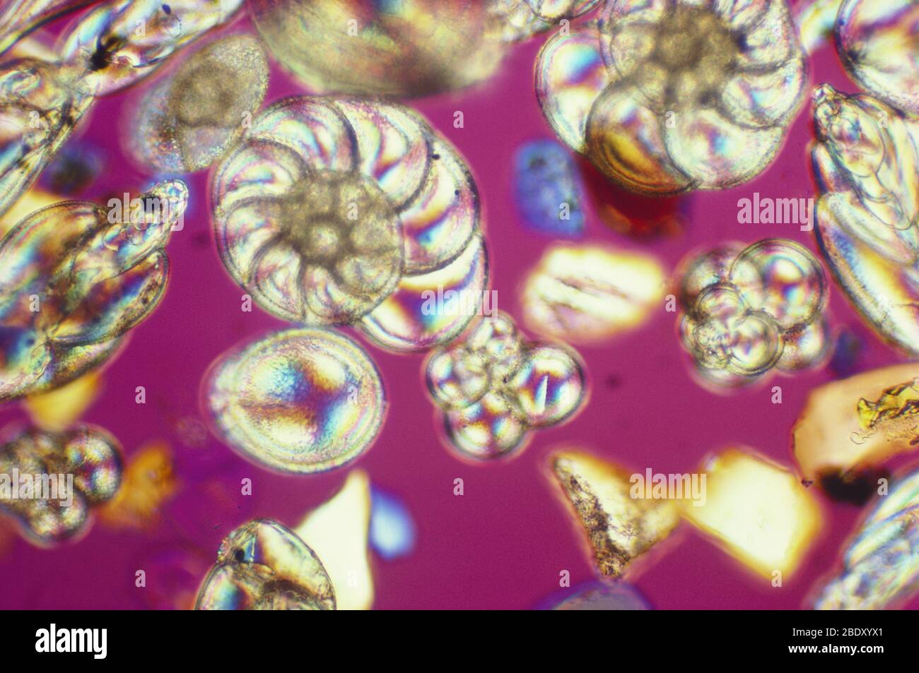 Foraminifera (LM) Stock Photo