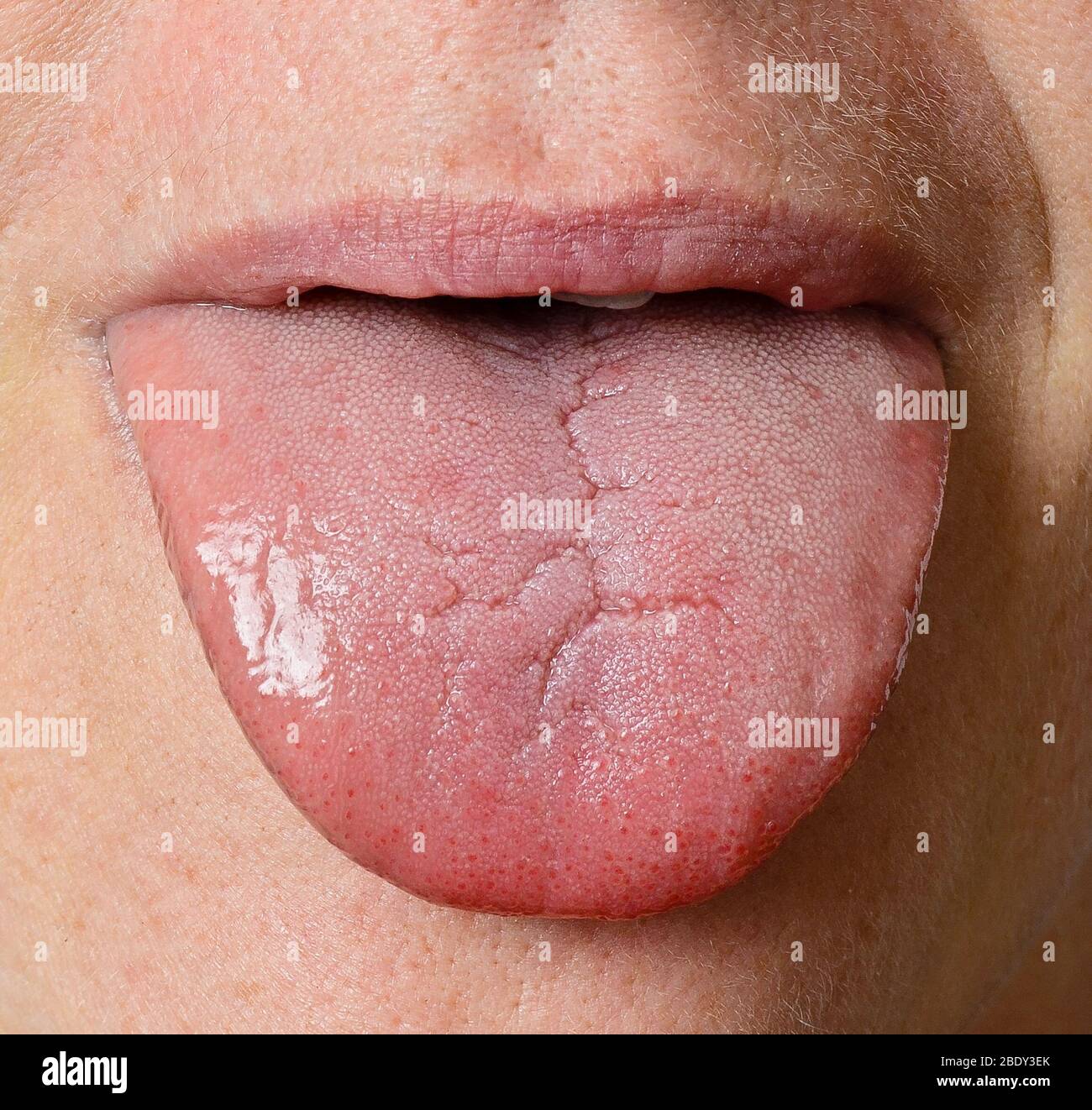 Human Tongue Stock Photo