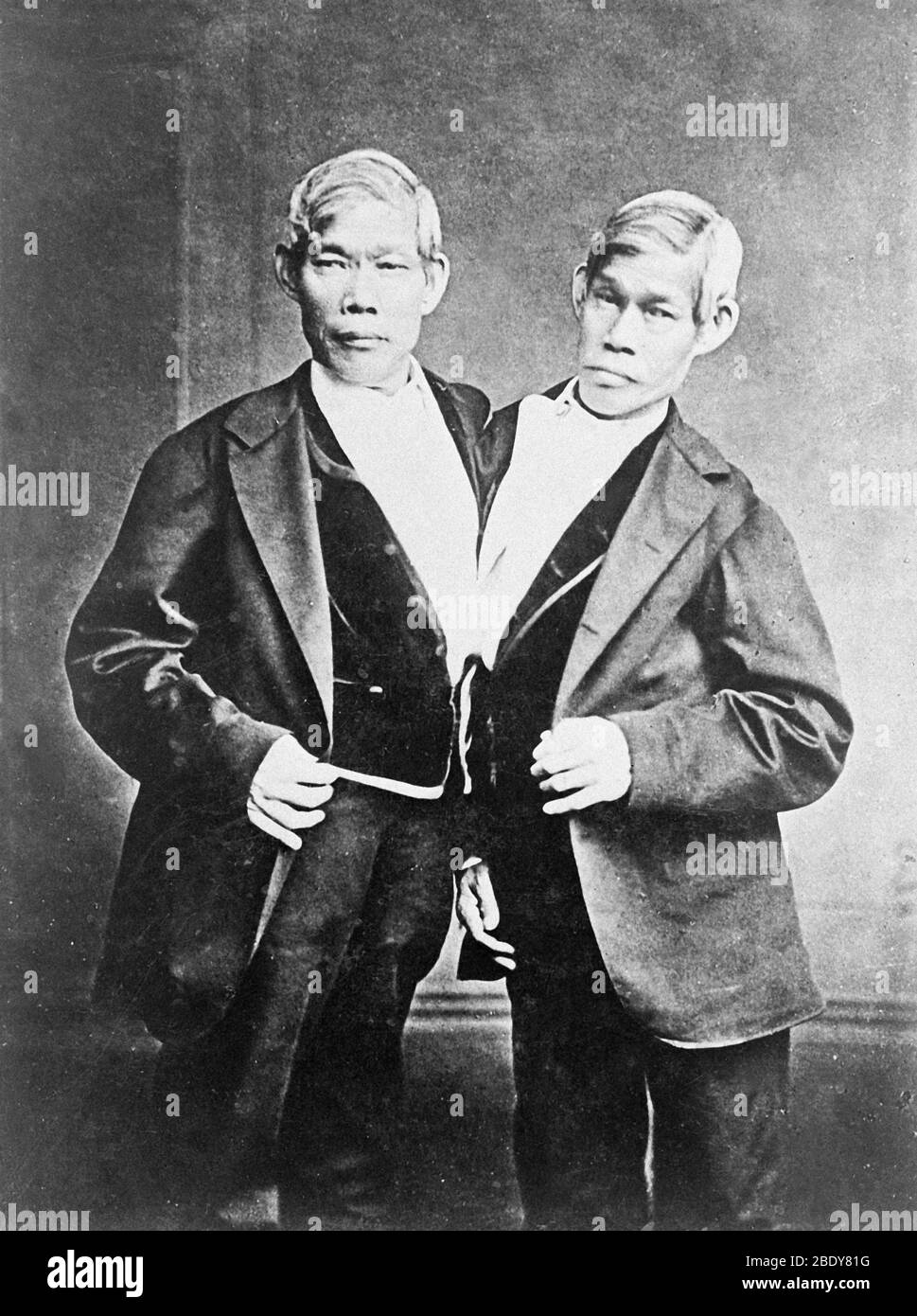 Chang and Eng, Siamese Twins Stock Photo