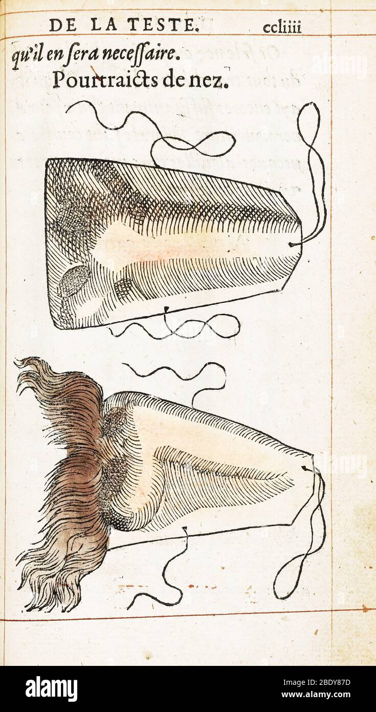 Prosthetic Noses, Ambroise Pare, 1561 Stock Photo