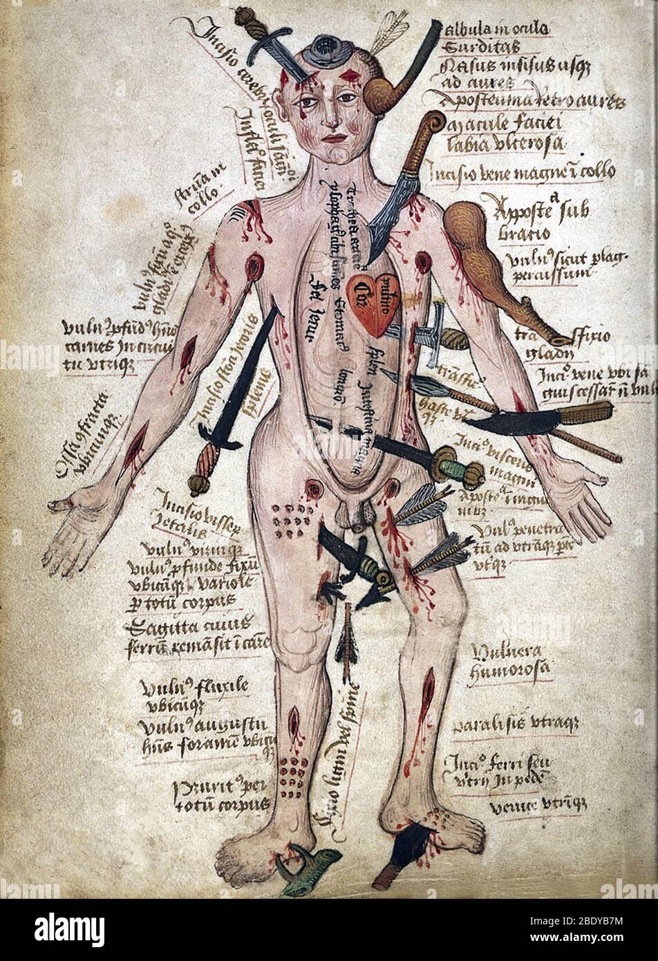 Wound Man, 15th Century Stock Photo