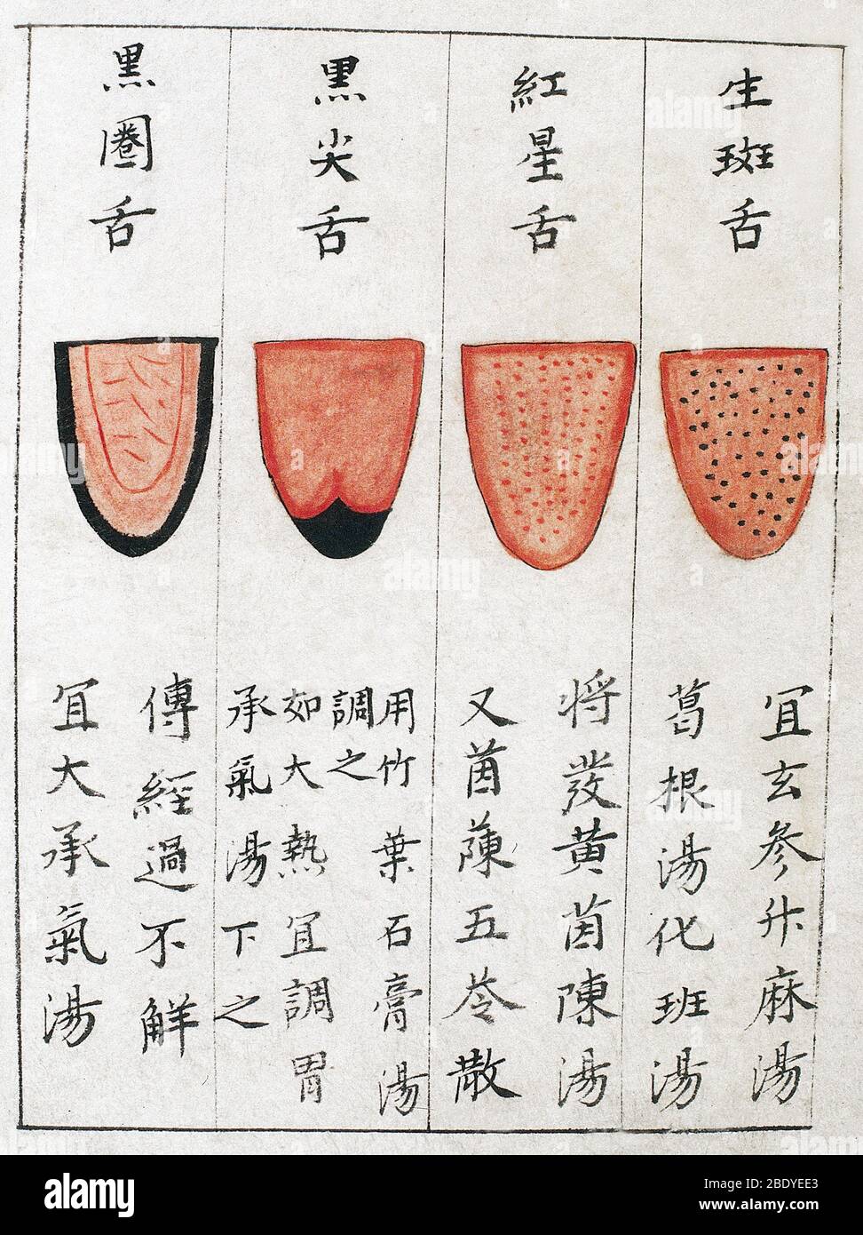 Chinese Tongue Diagnosis Chart, 1341 Stock Photo