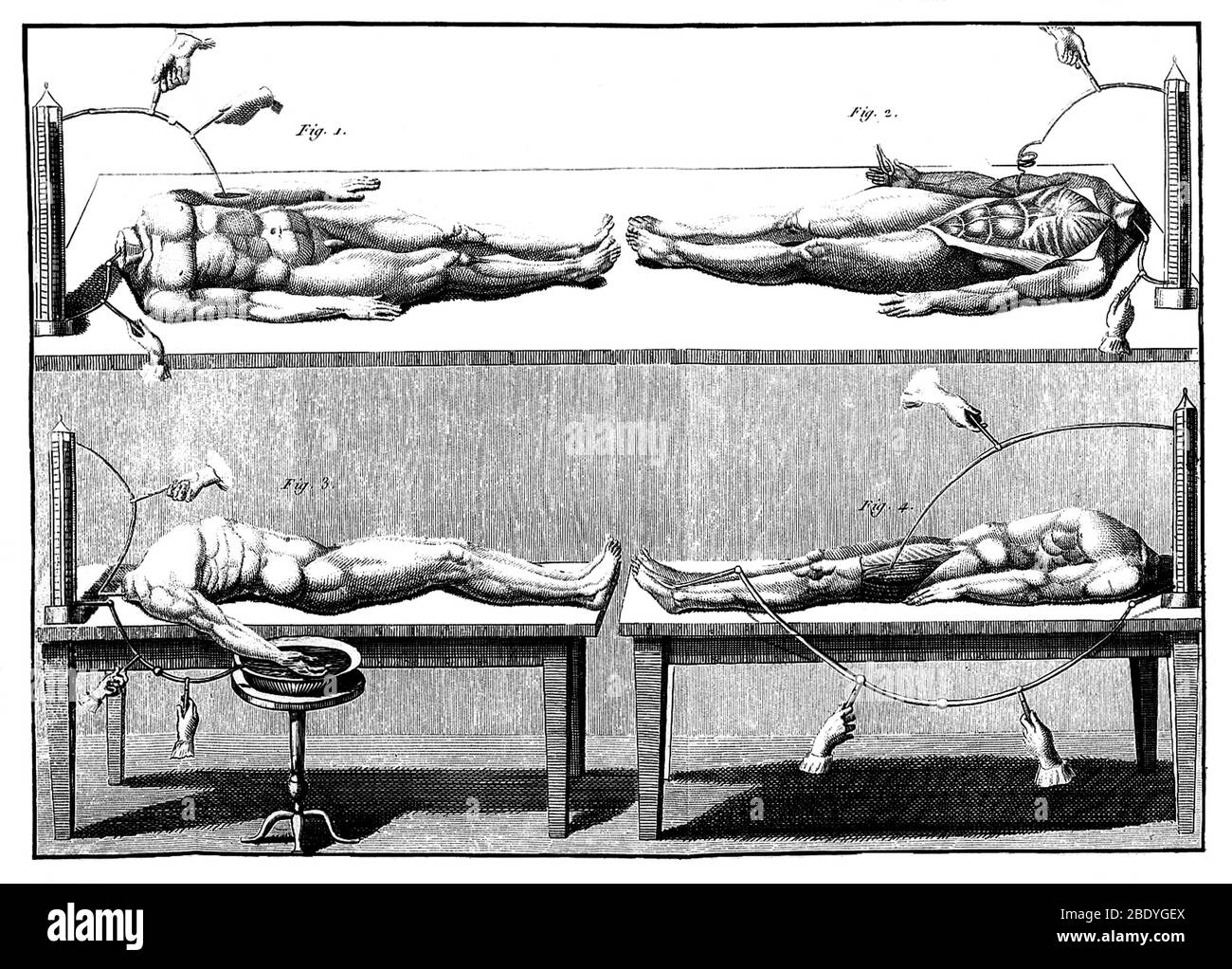 Luigi galvani experiment hires stock photography and images Alamy