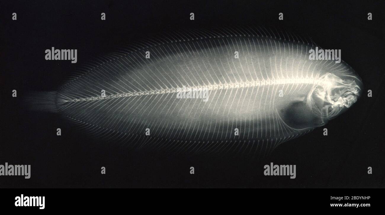 Xray of Righteye Flounder, 1896 Stock Photo Alamy