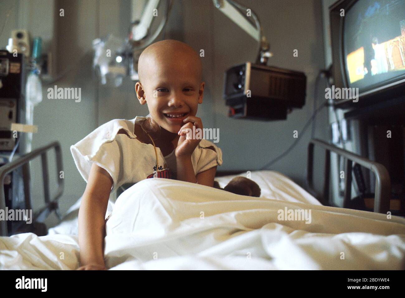 Child Undergoing Chemotherapy Stock Photo Alamy