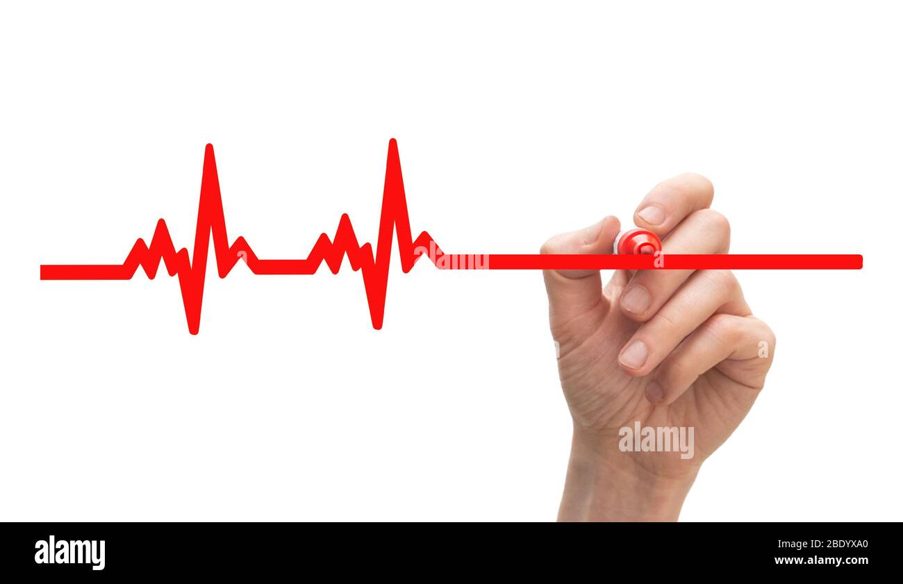Heartbeat monitor hi-res stock photography and images - Alamy
