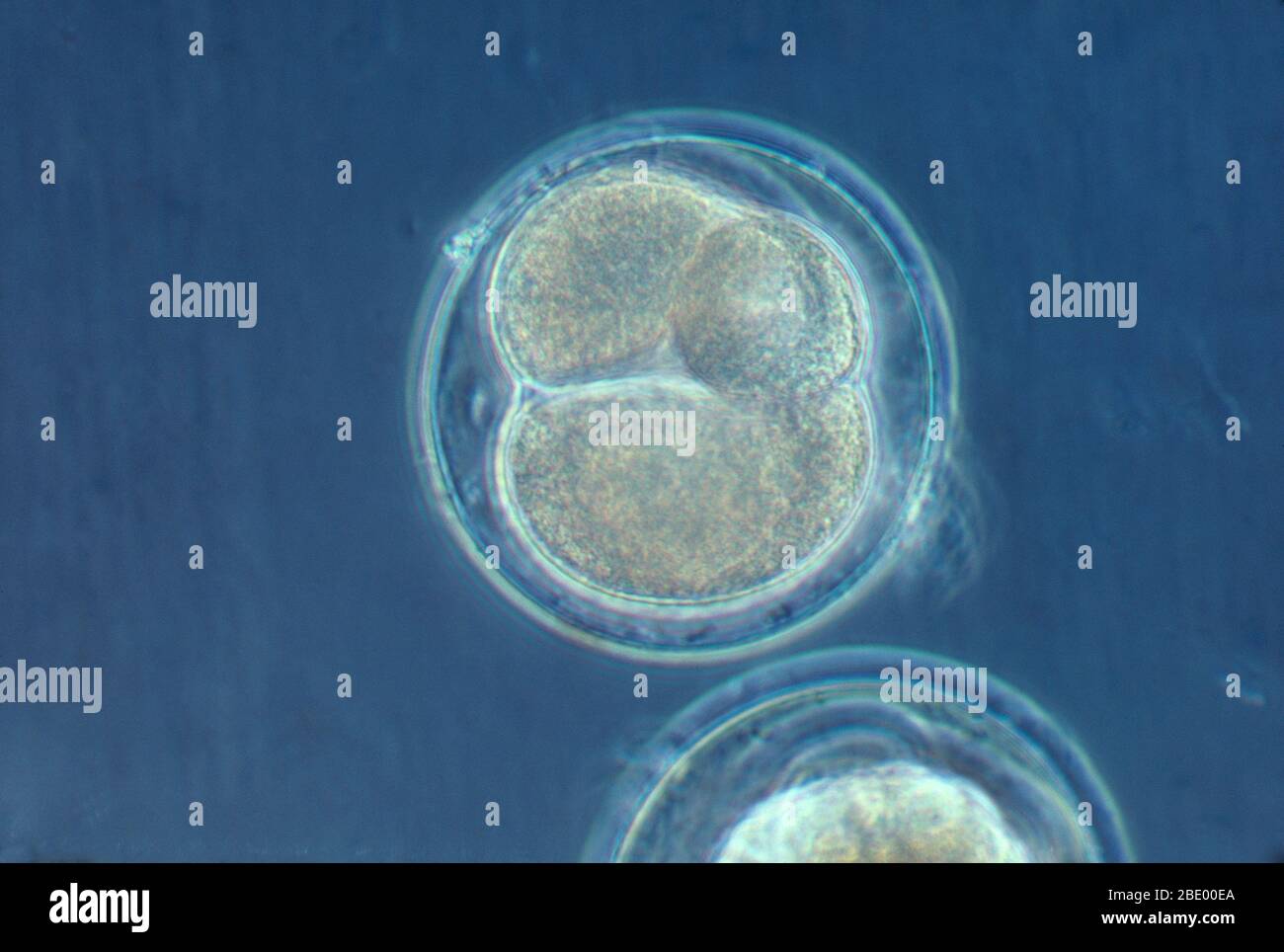 A) The normal circular trajectory of a sea urchin sperm is