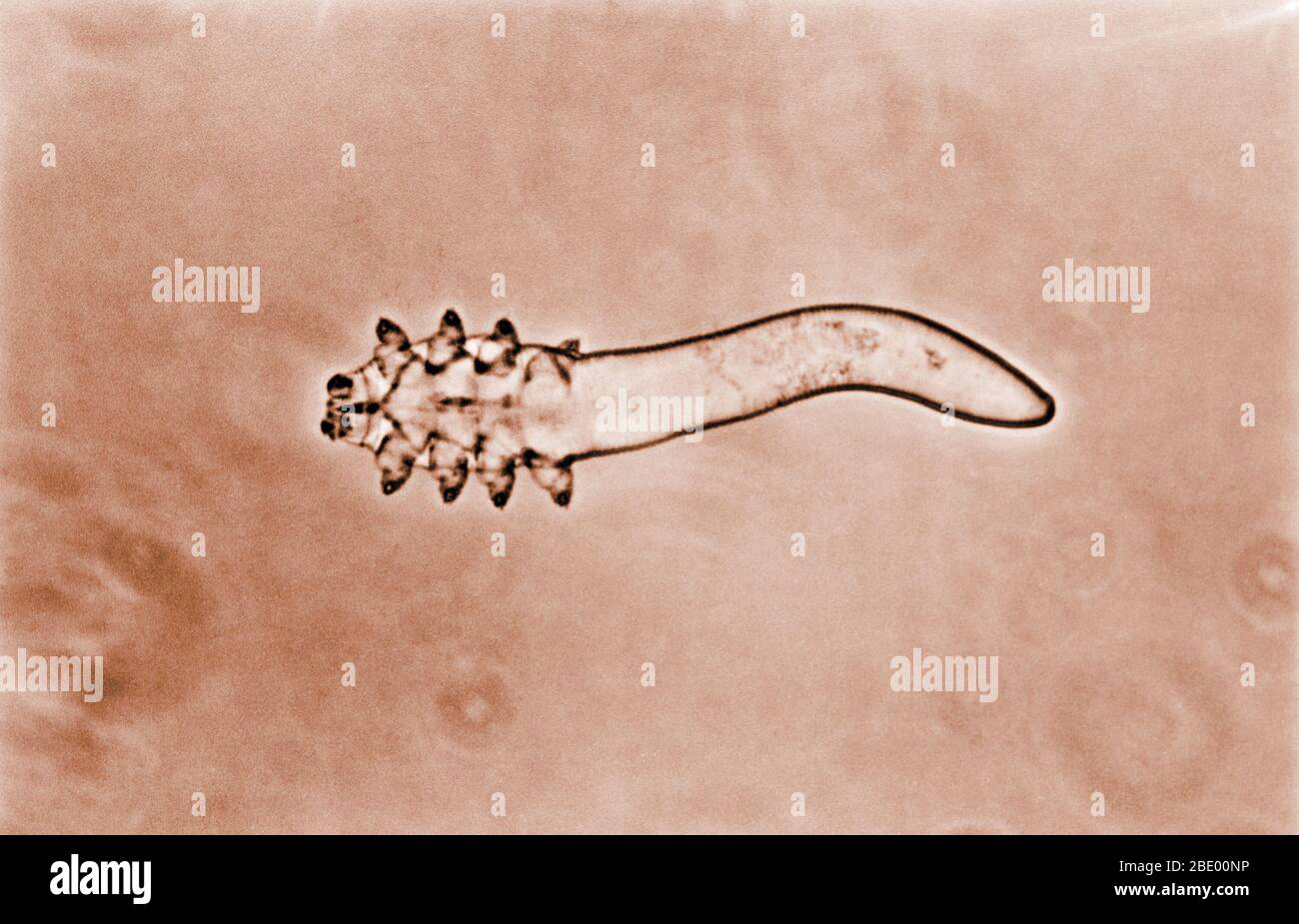Human hair hair follicle parasite sale