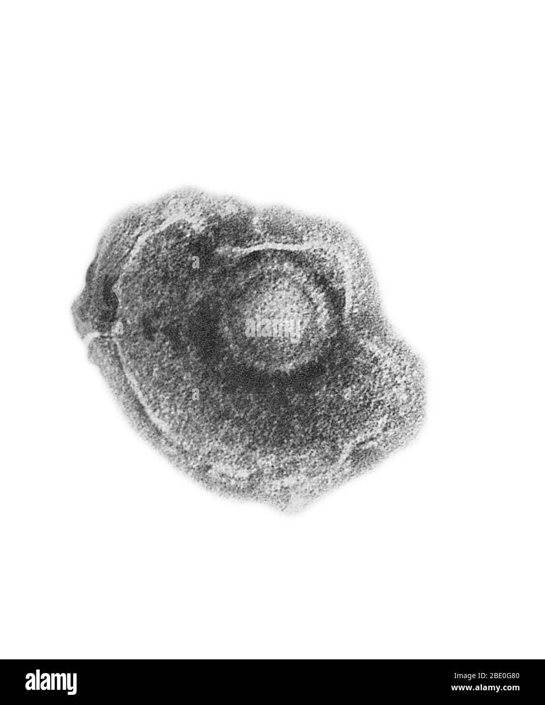 Transmission Electron Micrograph (TEM) of a Varicella zoster virus. Varicella zoster virus or varicella-zoster virus (VZV) is one of eight herpesviruses known to infect humans and vertebrates. VZV only affects humans, and commonly causes chickenpox in children, teens and young adults and herpes zoster (shingles) in adults and rarely in children. VZV is known by many names, including chickenpox virus, varicella virus, zoster virus, and human herpesvirus type 3 (HHV-3). VZV multiplies in the lungs, and causes a wide variety of symptoms. After the primary infection (chickenpox), the virus goes do Stock Photo