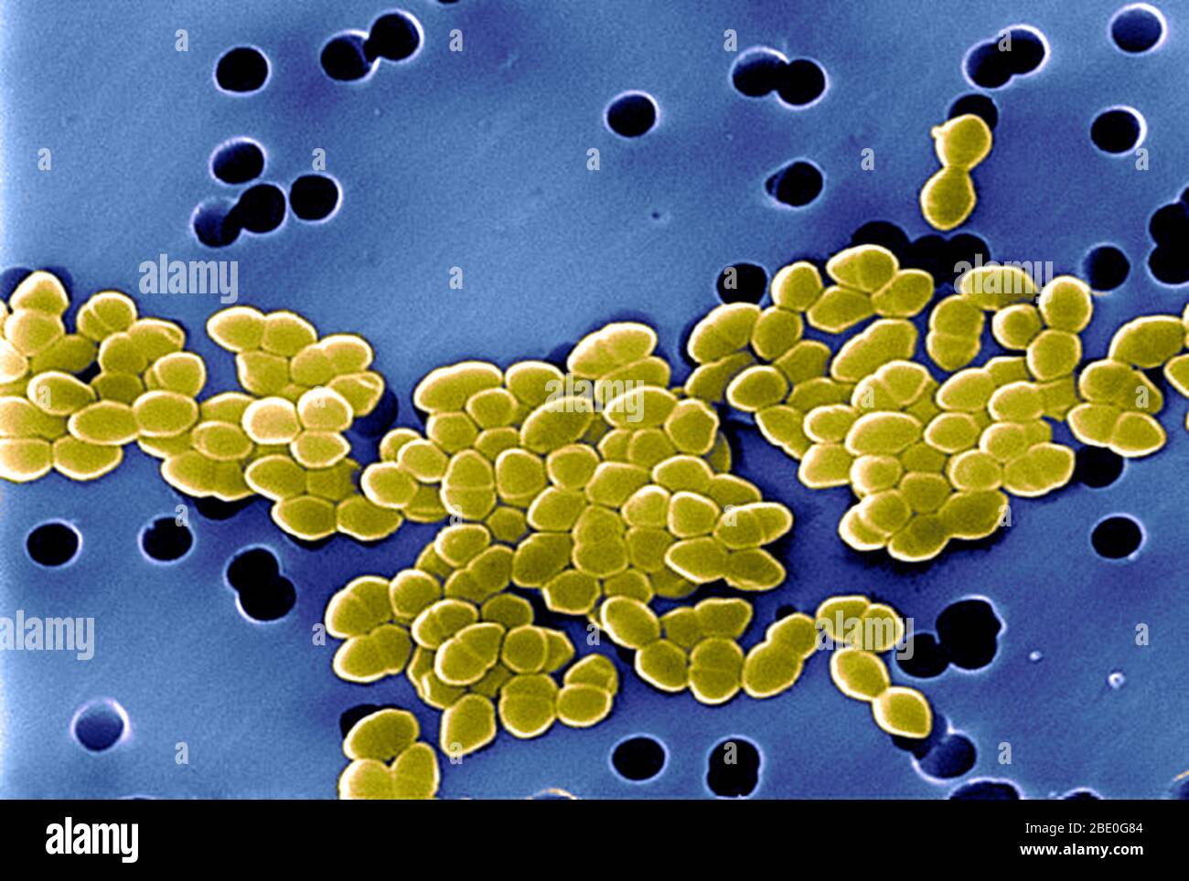 Vancomycin resistant enterococcus hi-res stock photography and images -  Alamy