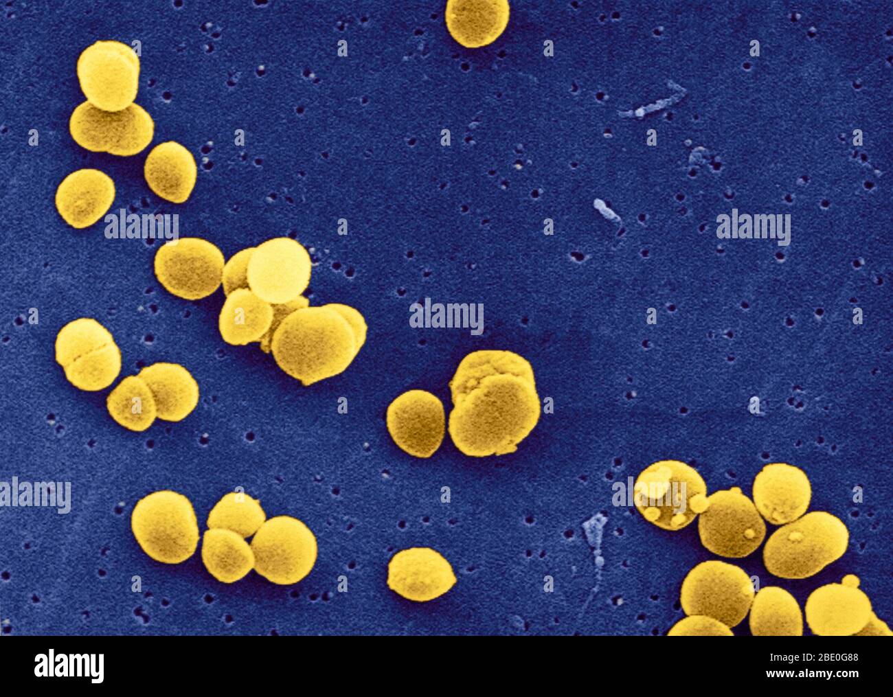 Color ehanced Scanning Electron Micrograph (SEM) of Staphylococcus