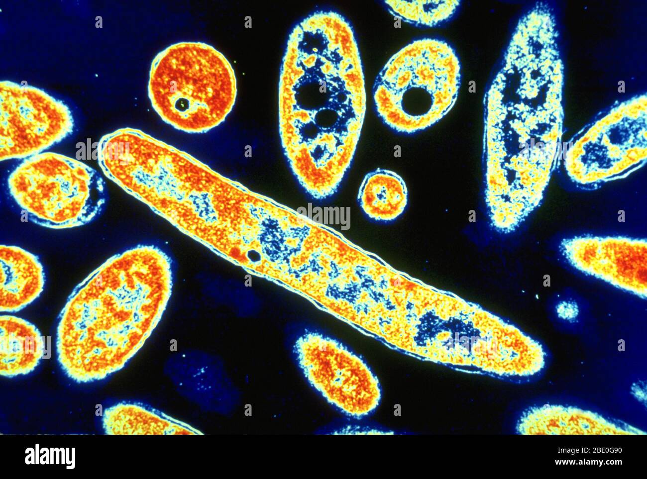 Color enhanced TEM of Legionnaires' disease bacteria (Legionella pneumophila) on bacteriologic medium with vacuoles present. TEM of Legionella pneumophila. Legionella pneumophila is a thin, aerobic, pleomorphic, flagellated, nonspore-forming, gram-negative bacterium of the genus Legionella. L. pneumophila is the primary human pathogenic bacterium in this group and is the causative agent of Legionnaires' disease, also known as legionellosis. The disease got its name in 1976 when an outbreak of pneumonia occurred at an American Legion convention in Philadelphia. Magnification @ 90,000x. Stock Photo