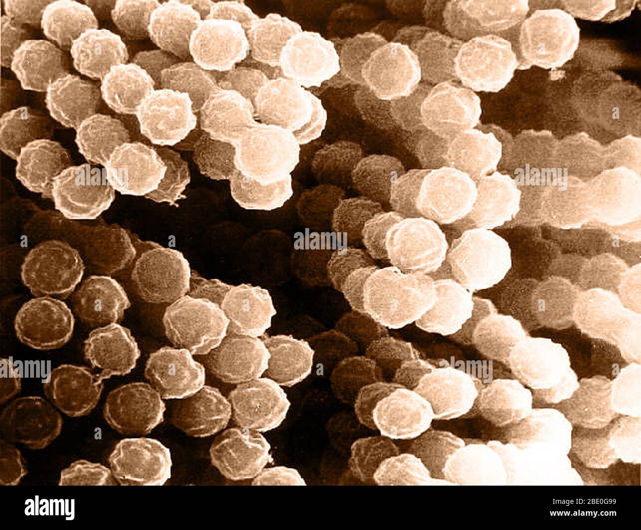 Color enhanced scanning electron micrograph (SEM) of Aspergillus species. Over 185 species of fungi are included in the genus Aspergillus, the most common being fumigatus. Aspergillus is a group of molds known to produce aflatoxins (a known carcinogen) that can infect feed crops and food. The fungi also can cause allergic illnesses, infections, and diseases known as Aspergillosis. Stock Photo