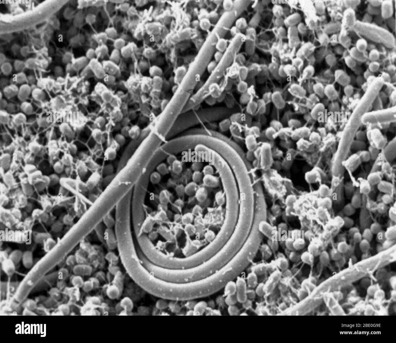 Cells of Salmonella enteritidis change shape as they grow. This scanning electron micrograph shows a mixture of small cells with filaments and very large cells that lack filaments. Small cells arise only during certain growth stages and efficiently contaminate eggs when the time is right. Stock Photo