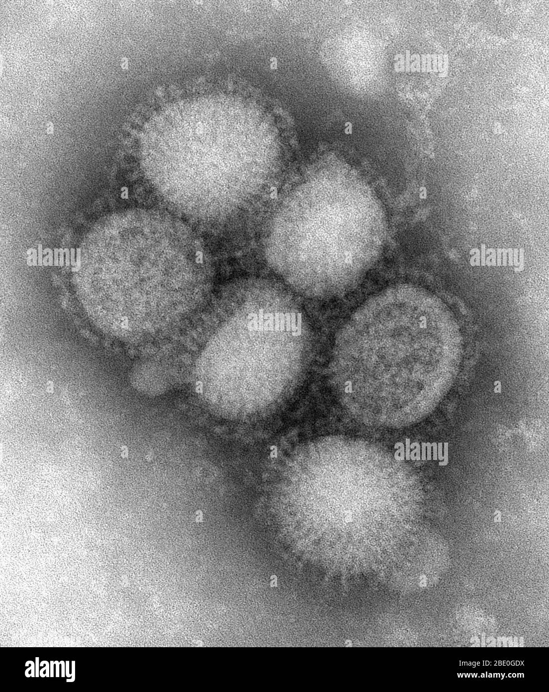 Negative stained transmission electron micrograph (TEM) of some of the ultrastructural morphology of the A/CA/4/09 swine flu virus. Swine Influenza (swine flu) is a respiratory disease of pigs caused by type A influenza virus that regularly causes outbreaks of influenza in pigs. Swine flu viruses cause high levels of illness and low death rates in pigs. Swine influenza viruses may circulate among swine throughout the year, but most outbreaks occur during the late fall and winter months similar to outbreaks in humans. The classical swine flu virus (an influenza type A H1N1 virus) was first isol Stock Photo