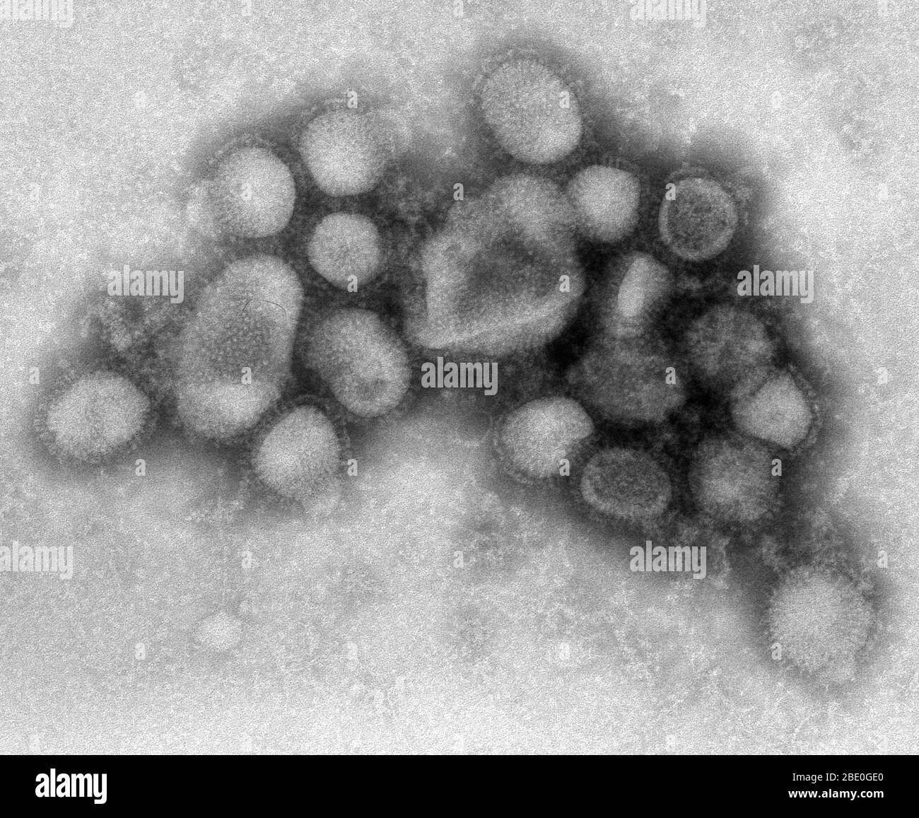 Negative stained transmission electron micrograph (TEM) of some of the ultrastructural morphology of the A/CA/4/09 swine flu virus. Swine Influenza (swine flu) is a respiratory disease of pigs caused by type A influenza virus that regularly causes outbreaks of influenza in pigs. Swine flu viruses cause high levels of illness and low death rates in pigs. Swine influenza viruses may circulate among swine throughout the year, but most outbreaks occur during the late fall and winter months similar to outbreaks in humans. The classical swine flu virus (an influenza type A H1N1 virus) was first isol Stock Photo