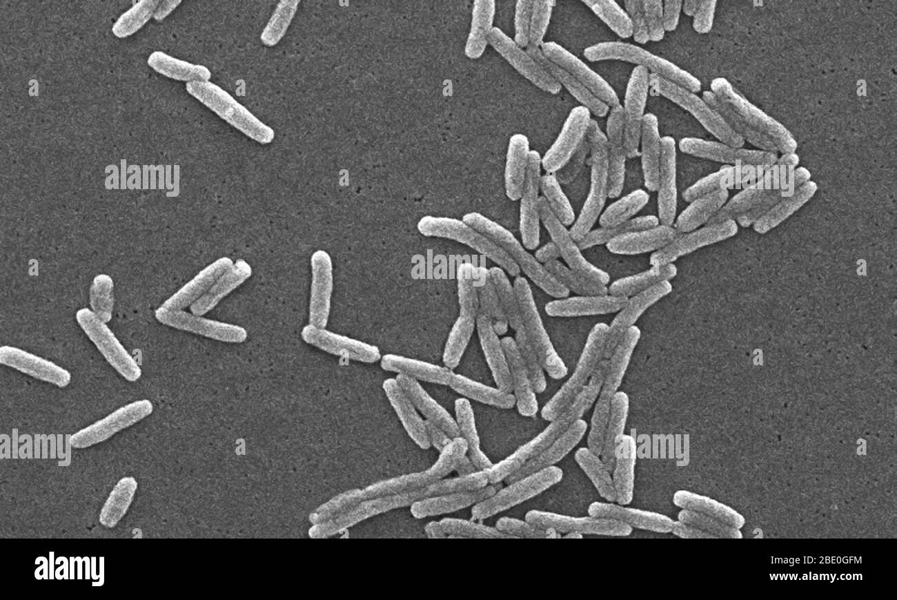 Scanning electron micrograph (SEM) of a number of a large grouping of Gram-negative Legionella pneumophila bacteria. Note the presence of polar flagella, and pili, or long streamers. a number of these bacteria seem to display an elongated-rod morphology. L. pneumophila are known to most frequently exhibit this configuration when grown in broth, however, they can also elongate when plate-grown cells age, as it was in this case, especially when they've been refrigerated. The usual L. pneumophila morphology consists of stout, 'fat' bacilli, which is the case for the vast majority of the organisms Stock Photo