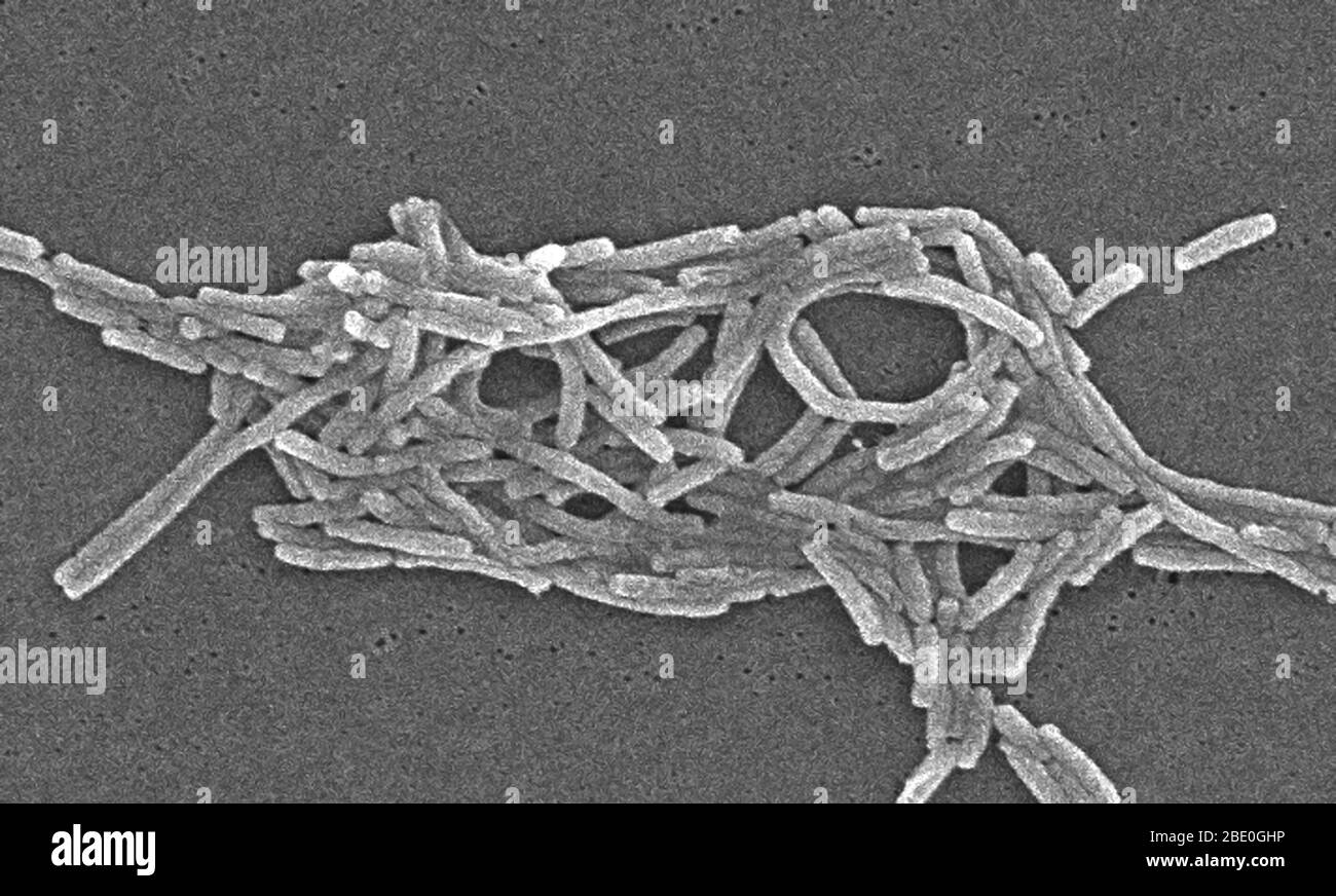 Scanning electron micrograph (SEM) of a number of a large grouping of Gram-negative Legionella pneumophila bacteria. Note the presence of polar flagella, and pili, or long streamers. a number of these bacteria seem to display an elongated-rod morphology. L. pneumophila are known to most frequently exhibit this configuration when grown in broth, however, they can also elongate when plate-grown cells age, as it was in this case, especially when they've been refrigerated. The usual L. pneumophila morphology consists of stout, 'fat' bacilli, which is the case for the vast majority of the organisms Stock Photo