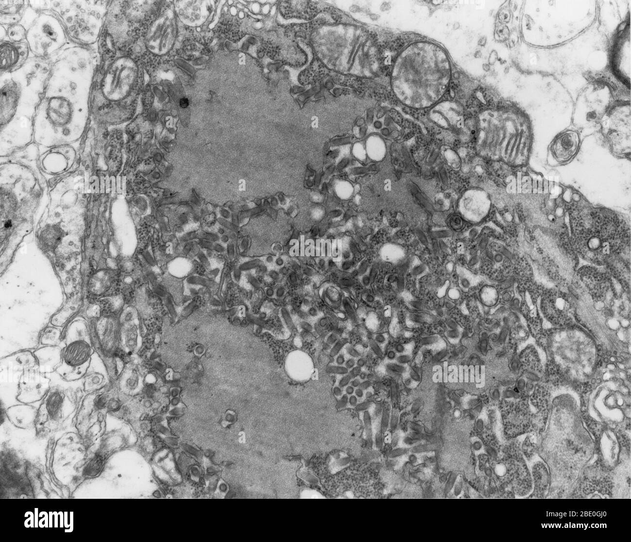 Transmission electron micrograph shows multiple rabies viruses, dark and bullet-shaped, within an infected tissue sample. Rabies is a preventable viral disease of mammals most often transmitted through the bite of a rabid animal. The vast majority of rabies cases reported to the Centers for Disease Control and Prevention (CDC) each year occur in wild animals like raccoons, skunks, bats, and foxes. Domestic animals account for less than 10% of the reported rabies cases, with cats, cattle, and dogs most often reported rabid. Stock Photo