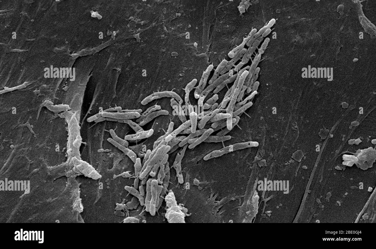 Scanning electron micrograph SEM) of a number of Gram-positive bacilli, or 'rod-shaped', Mycobacterium fortuitum bacteria. M. fortuitum is classified as a 'rapidly-growing' Mycobacterium, due to the fact that it can be grown on laboratory culture medium in less than 7 days. As a human pathogen, this organism has been determined to be the cause of skin infections, including furunculosis, i.e., boils, on the legs of people receiving pedicures in nail salons. As a nontuberculous bacterium (NTB), M. fortuitum is a member of the same genus as its cousin Mycobacterium tuberculosis, however, it is cl Stock Photo