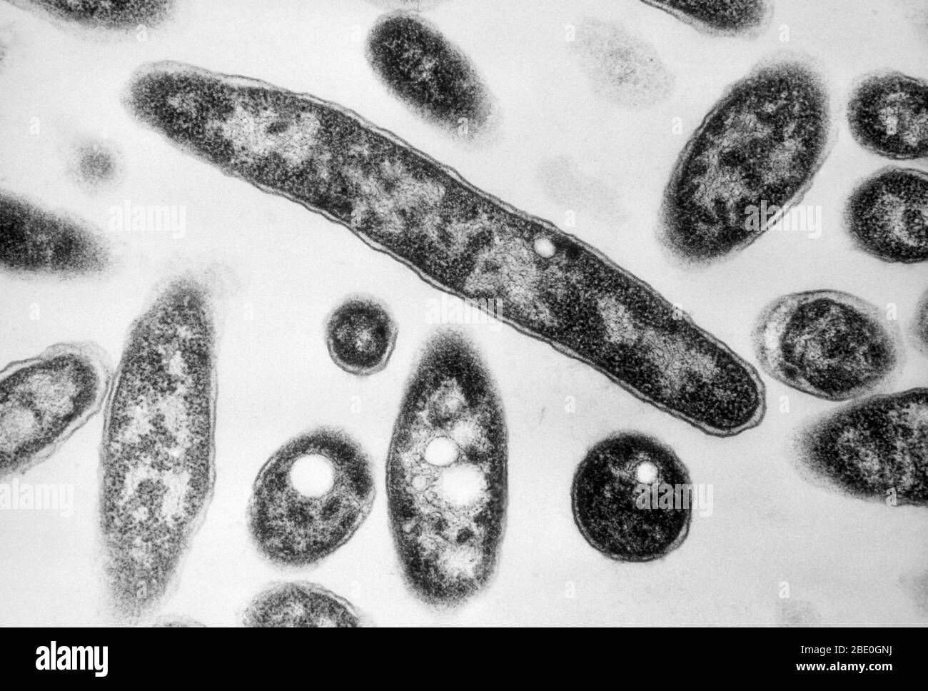Transmission Electron Micrograph (TEM) showing bacteria in the genus Legionella, with visible vacuoles. These pathogenic, Gram-negative bacteria cause legionellosis or Legionnaires' disesase. Bacteria on bacteriologic medium. Magnification: 90,000x at 35mm. Stock Photo