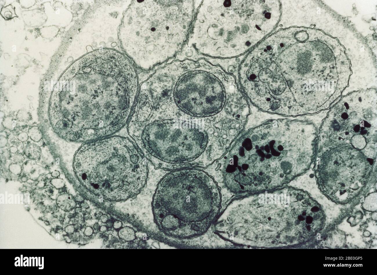 Transmission Electron Micrograph (TEM) showing Toxoplasma cyst. Toxoplasma is a parasitic protozoan that causes the disease Toxoplasmosis. Magnification unknown. Stock Photo