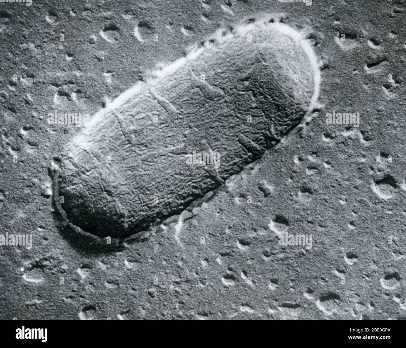 Scanning electron micrograph (SEM) of a platinum replica of a non-infectious mutant tuberculosis bacillum known as BGC. The picture was made by a new technique developed at Battelle Memorial Institute. The technique involves vacuum evaporation of platinum on the organism's surface.  With such an extremely thin deposit of platinum, it is possible to better examine the organism. Magnification = 80,000x. Stock Photo