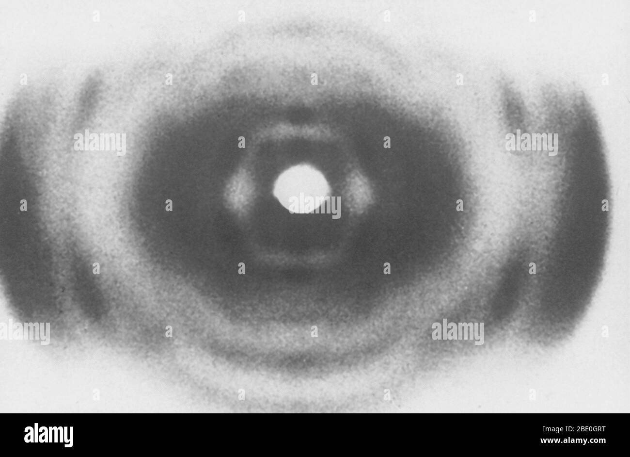 An X-ray of DNA, produced circa 1937, by William Thomas Astbury (1898-1961), a pioneer of DNA imaging. Stock Photo