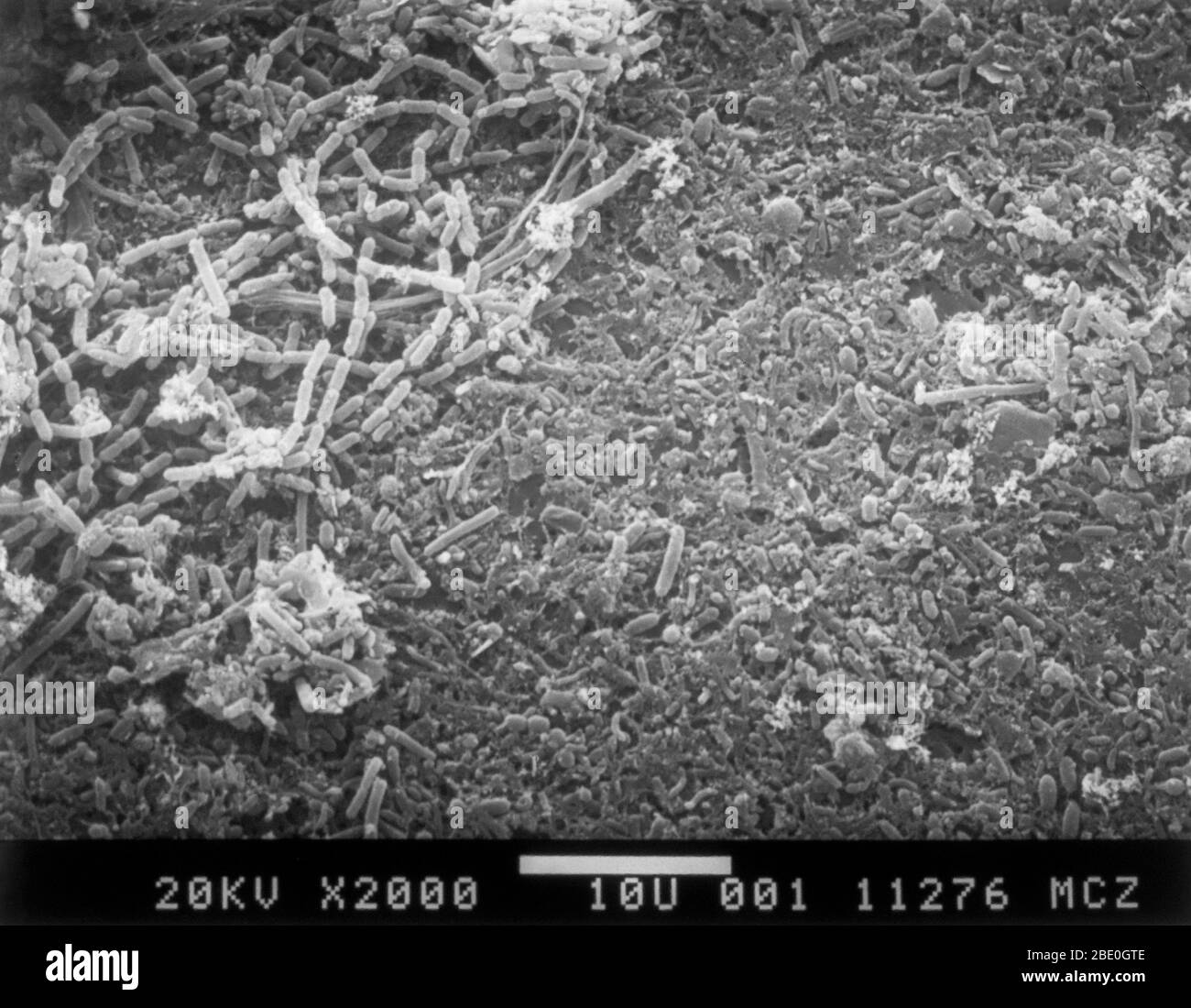 Scanning Electron Micrograph (SEM) of raw sewage filtered onto a nucleopore membrane. Note the filamentous bacterium and various rod-shaped bacteria. Magnification 2000x at 35mm image size. Stock Photo