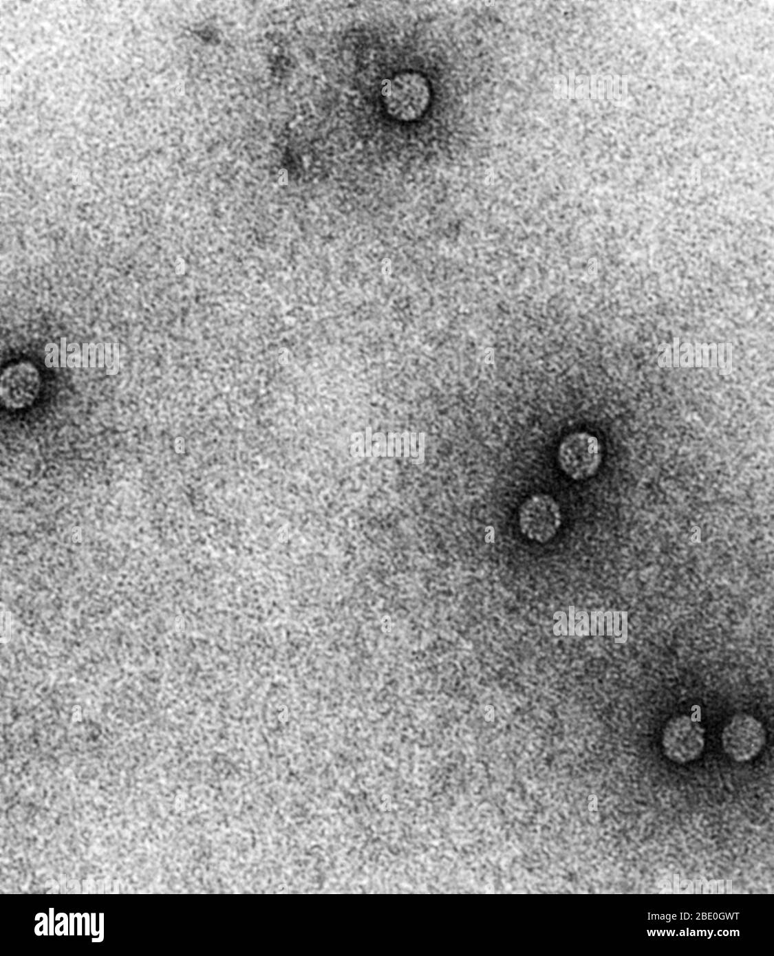 Transmission electron micrograph (TEM) of rhinoviruses, which cause the common cold.  Magnification: x200,000. Stock Photo