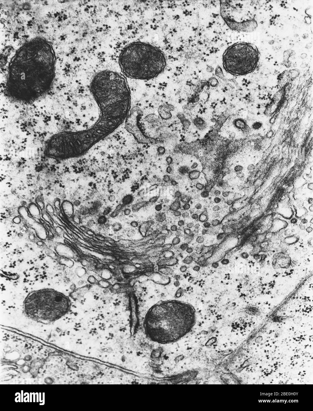 Transmission electron micrograph (TEM) of lysosomes. A lysosome is a membrane-bound organelle found in nearly all animal cells. They are spherical vesicles which contain hydrolytic enzymes that can break down virtually all kinds of biomolecules (waste materials and cellular debris). The name lysosome derives from the Greek words lysis, to separate, and soma, body. They are frequently nicknamed 'suicide-bags' or 'suicide-sacs' by cell biologists due to their role in autolysis, more commonly known as self-digestion, refers to the destruction of a cell through the action of its own enzymes. Magni Stock Photo