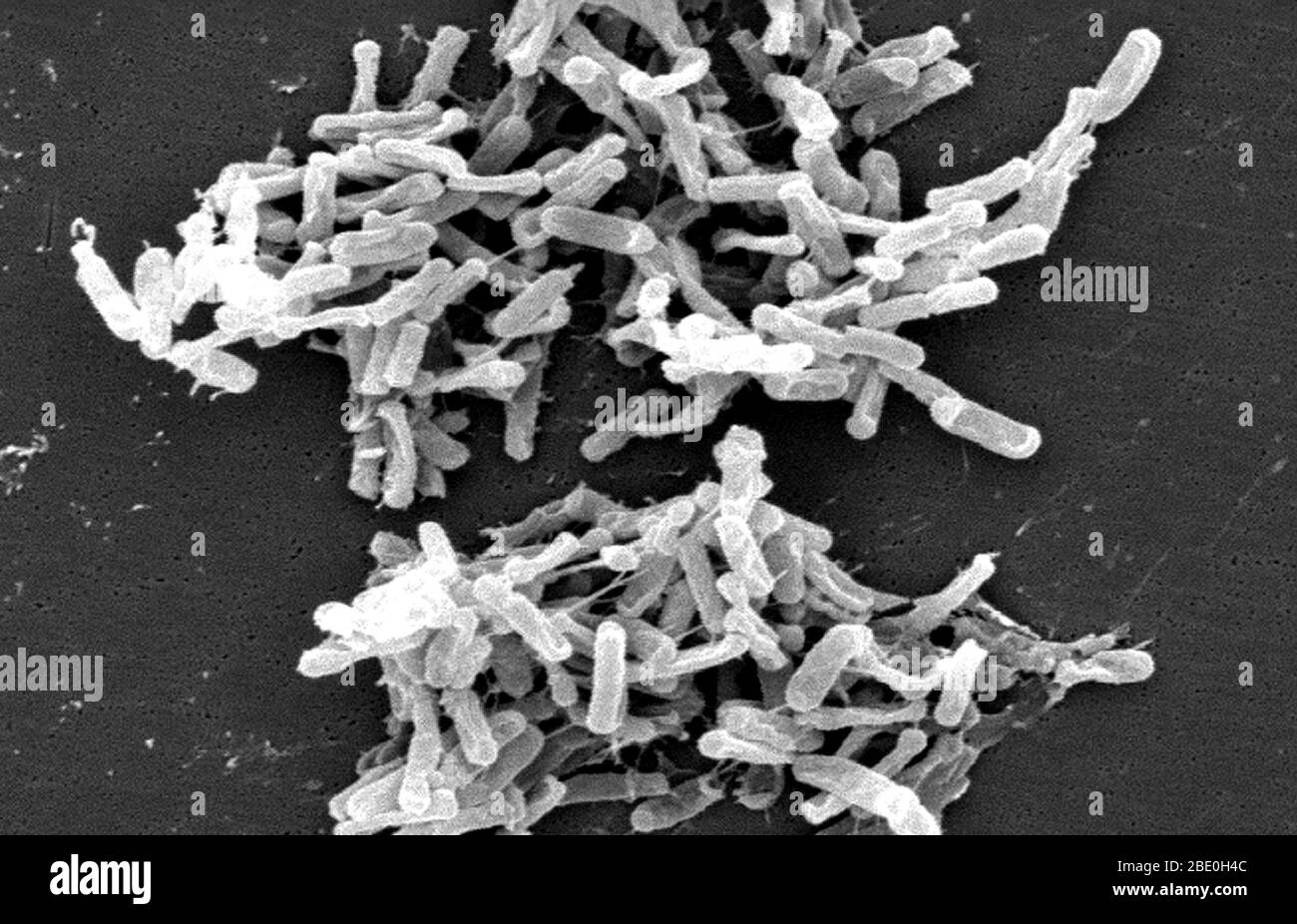 Scanning Electron Micrograph (SEM) showing Gram-positive Clostridium difficile bacteria. These C. difficile organisms were cultured from a stool sample obtained during an outbreak of gastrointestinal illness, and extracted using a .1µm filter. C. difficile causes diarrhea, and more serious intestinal conditions such as colitis. Stock Photo