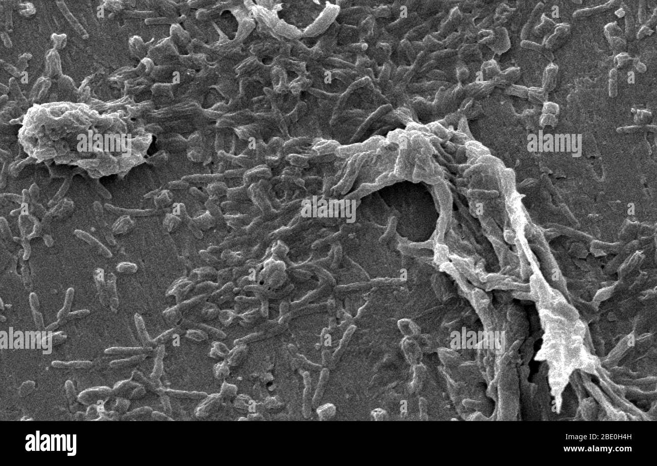 Scanning Electron Micrograph (SEM) showing Legionella pneumophila on biofilm; magnification: 3200X. This organism is the causative agent of Legionnaires' Disease. Stock Photo