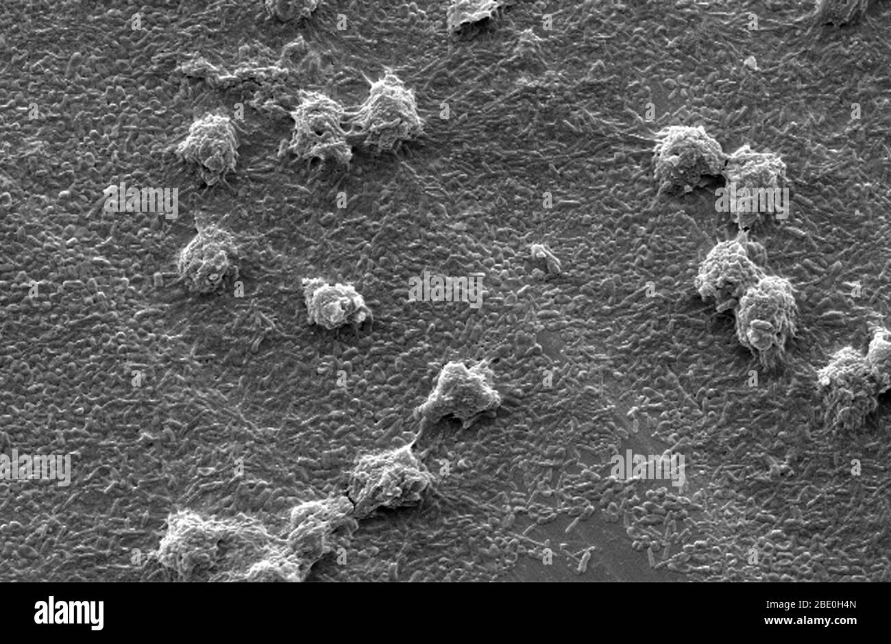 Scanning Electron Micrograph (SEM) showing ultrastructural morphology exhibited by a number of Vermamoeba vermiformis (Hartmannella) amoebae trophozoites. As part of a study to determine whether Legionella pneumophila bacteria can colonize and grow in biofilms with or without the presence of V. vermiformis, here these protozoa were situated atop a base biofilm composed of Pseudomonas aeruginosa, Klebsiella pneumoniae and a Flavobacterium sp. bacteria. Note that the amoebae were grazing upon these bacteria which reveals the scoured stainless steel coupon surface. Vermamoeba vermiformis a free-l Stock Photo