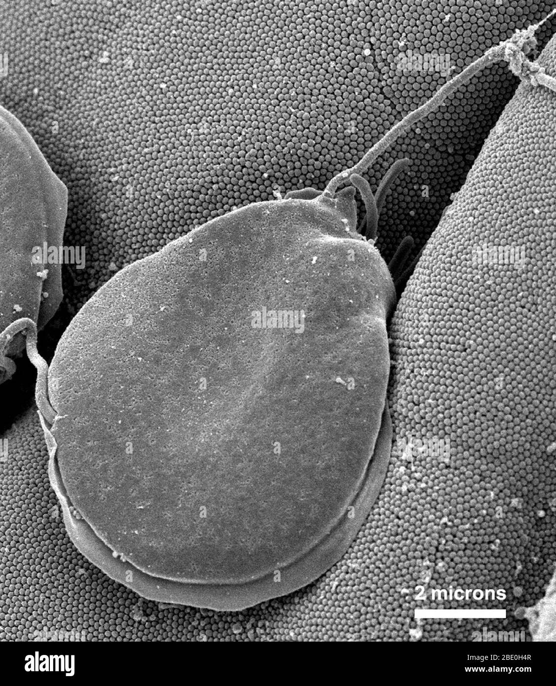 Scanning Electron Micrograph (SEM) showing Giardia muris protozoan settled atop intestinal mucosal villi, adhering itself to the microvillous border of intestinal epithelial cells. Each small circular profile under the protozoan represents the rounded tip of a single microvillous, and it is estimated that 2000 to 3000 microvilli cover the surface of a single intestinal epithelial cell. The protozoan Giardia causes the diarrheal disease called giardiasis. Stock Photo