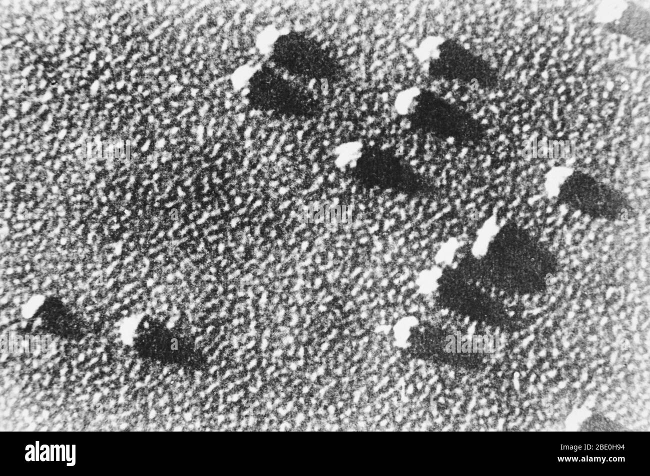 Scanning electron micrograph (SEM) showing ribosome particles. The ribosome is a complex molecular machine, found within all living cells, that serves as the site of biological protein synthesis (translation). Ribosomes link amino acids together in the order specified by messenger RNA (mRNA) molecules. Ribosomes consist of two major components: the small ribosomal subunit, which reads the RNA, and the large subunit, which joins amino acids to form a polypeptide chain. Each subunit is composed of one or more ribosomal RNA (rRNA) molecules and a variety of ribosomal proteins (r-protein or rProte Stock Photo