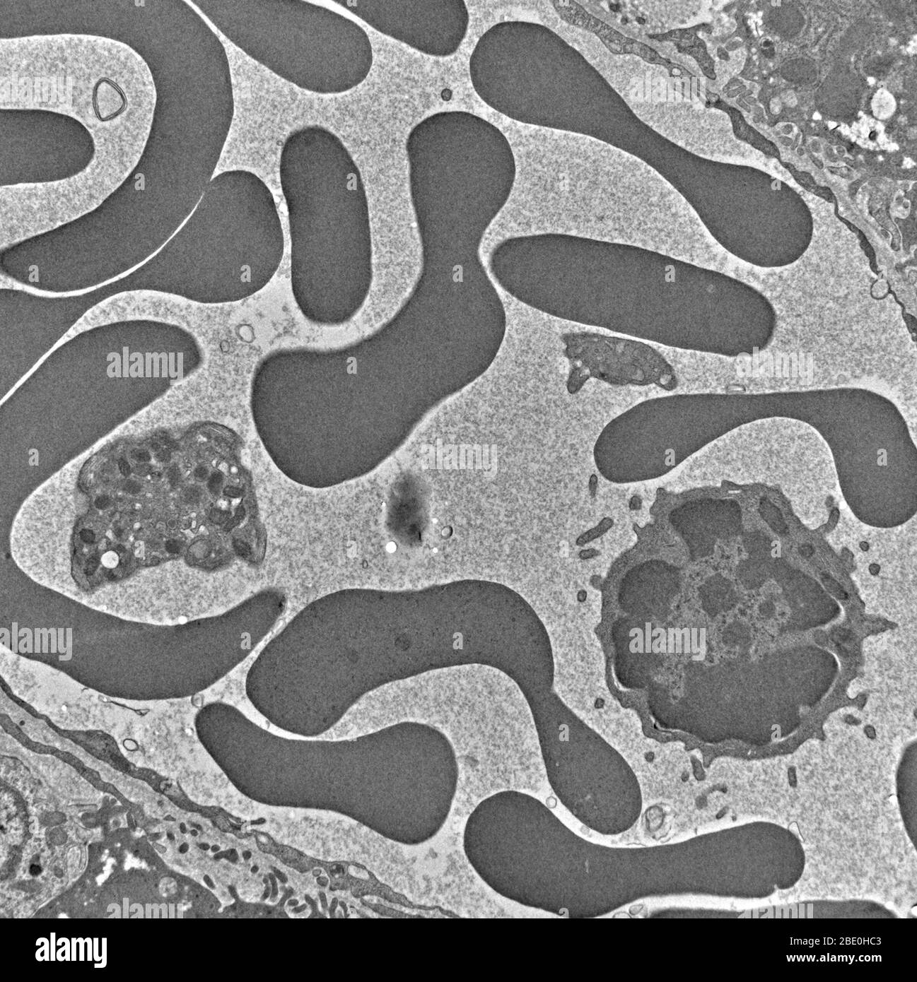 Transmission Electron Micrograph (TEM) of blood sample, showing red blood cells, platelet and white blood cell (lymphocyte). Magnification unknown. Stock Photo