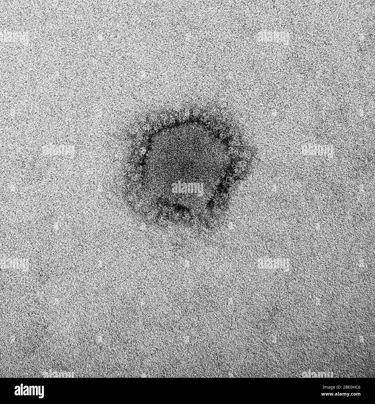 Negative-stain transmission electron micrograph (TEM) showing a MERS-CoV particle with club-shaped surface projections surrounding the periphery of the particle, which is a characteristic feature of coronaviruses. Middle East respiratory syndrome coronavirus (MERS-CoV) is a novel coronavirus (nCoV) first reported on 24 September 2012 by Egyptian virologist Dr. Ali Mohamed Zaki in Jeddah, Saudi Arabia. He isolated and identified a previously unknown coronavirus from the lungs of a 60-year-old male patient with acute pneumonia and acute renal failure. MERS-CoV is the sixth new type of coronaviru Stock Photo
