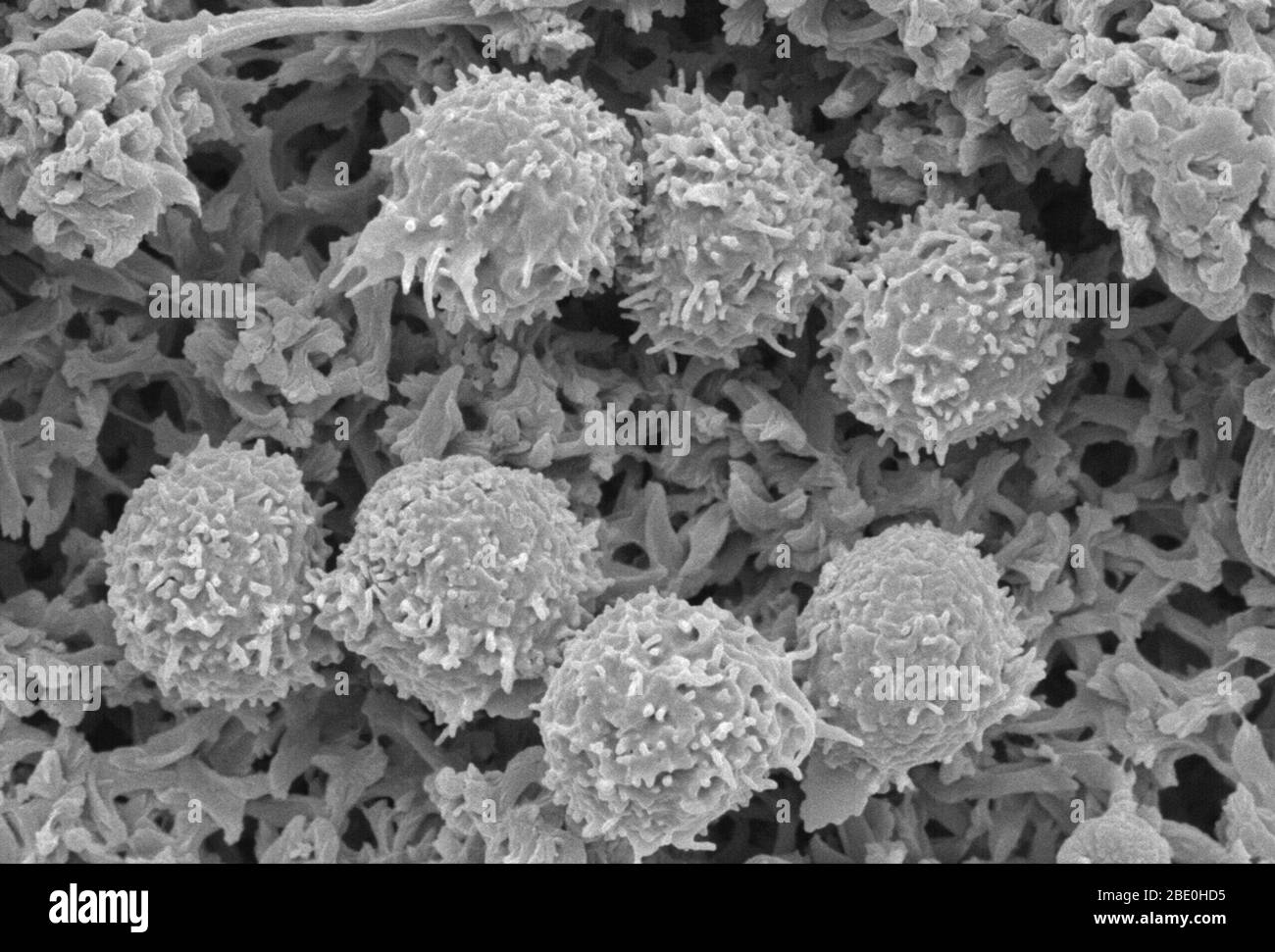 Scanning Electron Micrograph (SEM) showing lymphocytes (white blood cells). A lymphocyte is one of the subtypes of white blood cell in a vertebrate's immune system. Lymphocytes include natural killer cells (NK cells) (which function in cell-mediated, cytotoxic innate immunity), T cells (for cell-mediated, cytotoxic adaptive immunity), and B cells (for humoral, antibody-driven adaptive immunity). They are the main type of cell found in lymph, which prompted the name lymphocyte. Magnification unknown. Stock Photo
