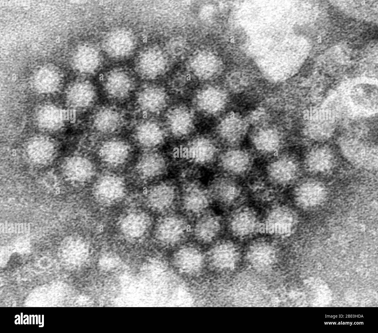 This transmission electron micrograph (TEM) revealed some of the ultrastructural morphology displayed by norovirus virions, or virus particles. Noroviruses belong to the genus Norovirus, and the family Caliciviridae. They are a group of related, single-stranded RNA, nonenveloped viruses that cause acute gastroenteritis in humans. Norovirus was recently approved as the official genus name for the group of viruses provisionally described as Norwalk-like viruses (NLV). Stock Photo