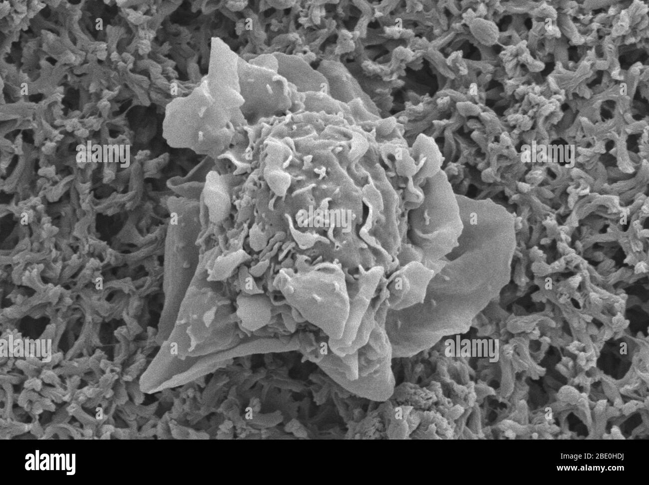 Scanning Electron Micrograph (SEM) showing an immature dendritic cell. Dendritic cells (DCs) are antigen-presenting cells (accessory cells) of the mammalian immune system. Their main function is to process antigen material and present it on the cell surface to the T cells of the immune system. They act as messengers between the innate and the adaptive immune systems. Dendritic cells are present in those tissues that are in contact with the external environment, such as the skin and the inner lining of the nose, lungs, stomach and intestines. They can also be found in an immature state in the b Stock Photo