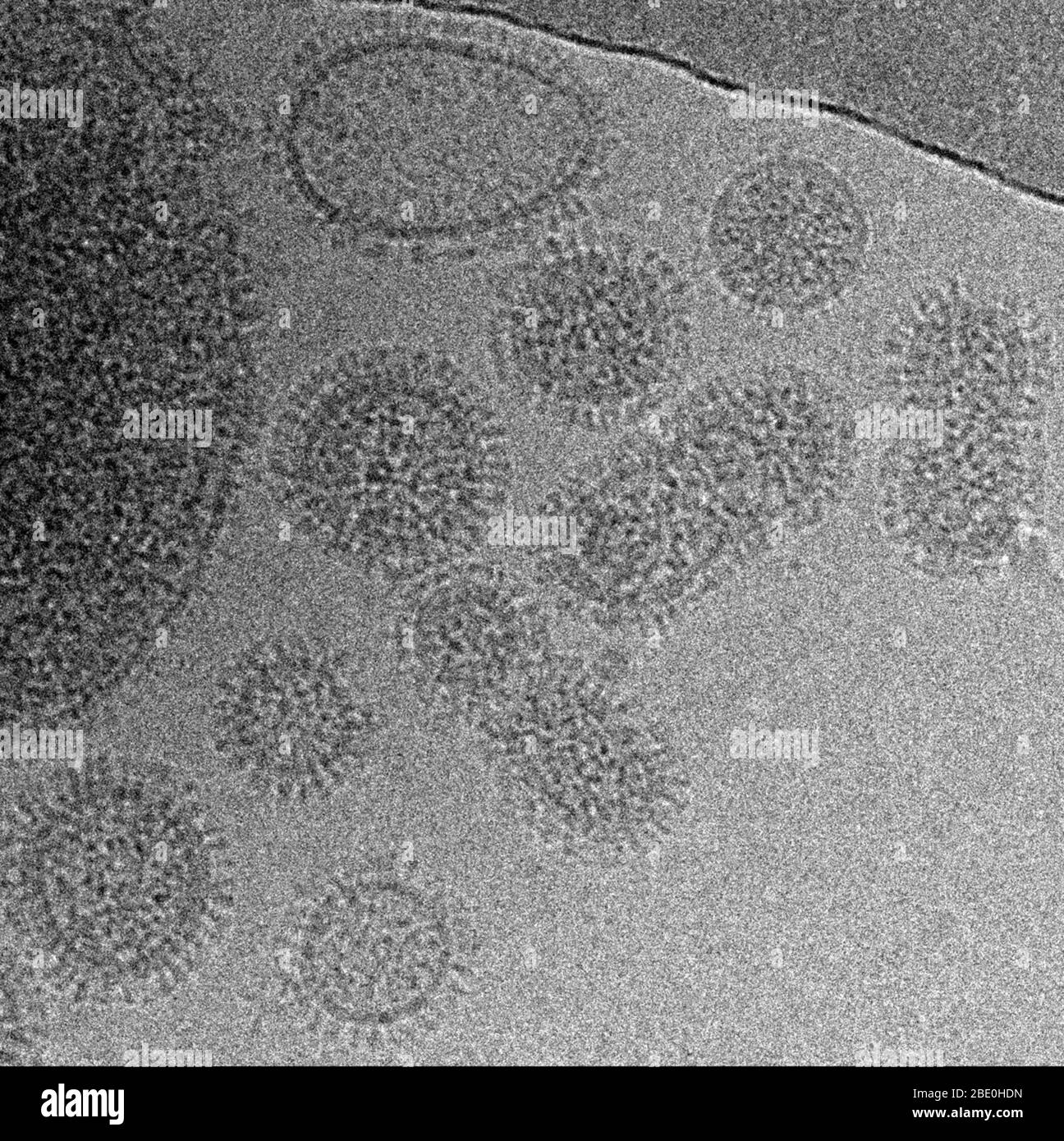 Cryo-EM image of the Influenza A (H1N1) virus, PR8 strain. Influenza A (H1N1) virus is the subtype of influenza A virus that was the most common cause of human influenza (flu), and is associated with the 1918 outbreak known as the Spanish Flu. In 2009, the World Health Organization (WHO) declared the new strain of swine-origin H1N1 as a pandemic. This strain is often called swine flu by the public media. This novel virus spread worldwide and had caused about 17,000 deaths by the start of 2010. In 2010, WHO declared that the H1N1 influenza pandemic over, saying worldwide flu activity had return Stock Photo