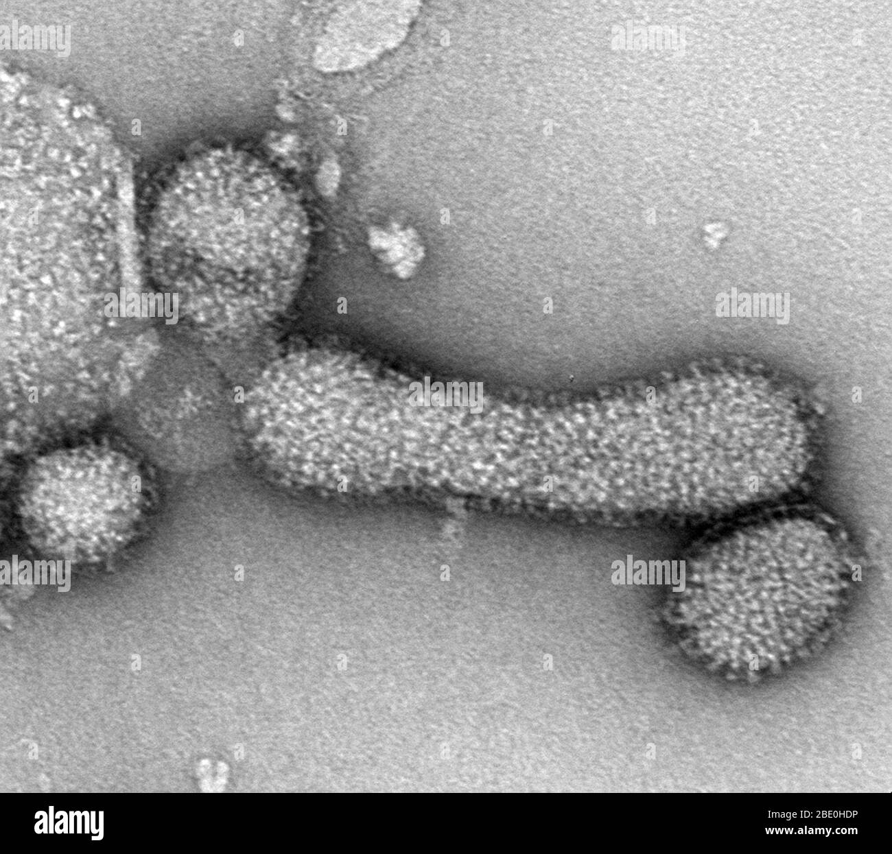 Negative stain Transmission Electron Micrograph (TEM) of the Influenza A (H1N1) virus, PR8 strain. Magnification unknown. Stock Photo