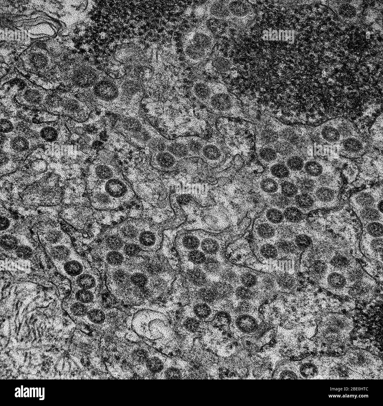 Transmission electron micrograph of Middle Eastern Respiratory Syndrome virusCoV particles found in the lumen of the endoplasmic reticulum in an infected MRC-5 cell. The Middle East respiratory syndrome coronavirus (MERS-CoV), also termed EMC/2012 (HCoV-EMC/2012), is positive-sense, single-stranded RNA novel species of the genus Betacoronavirus. First called novel coronavirus 2012 or simply novel coronavirus, it was first reported in 2012 after genome sequencing of a virus isolated from sputum samples from patients who fell ill in a 2012 outbreak of a new flu. As of June 2014, MERS-CoV cases h Stock Photo