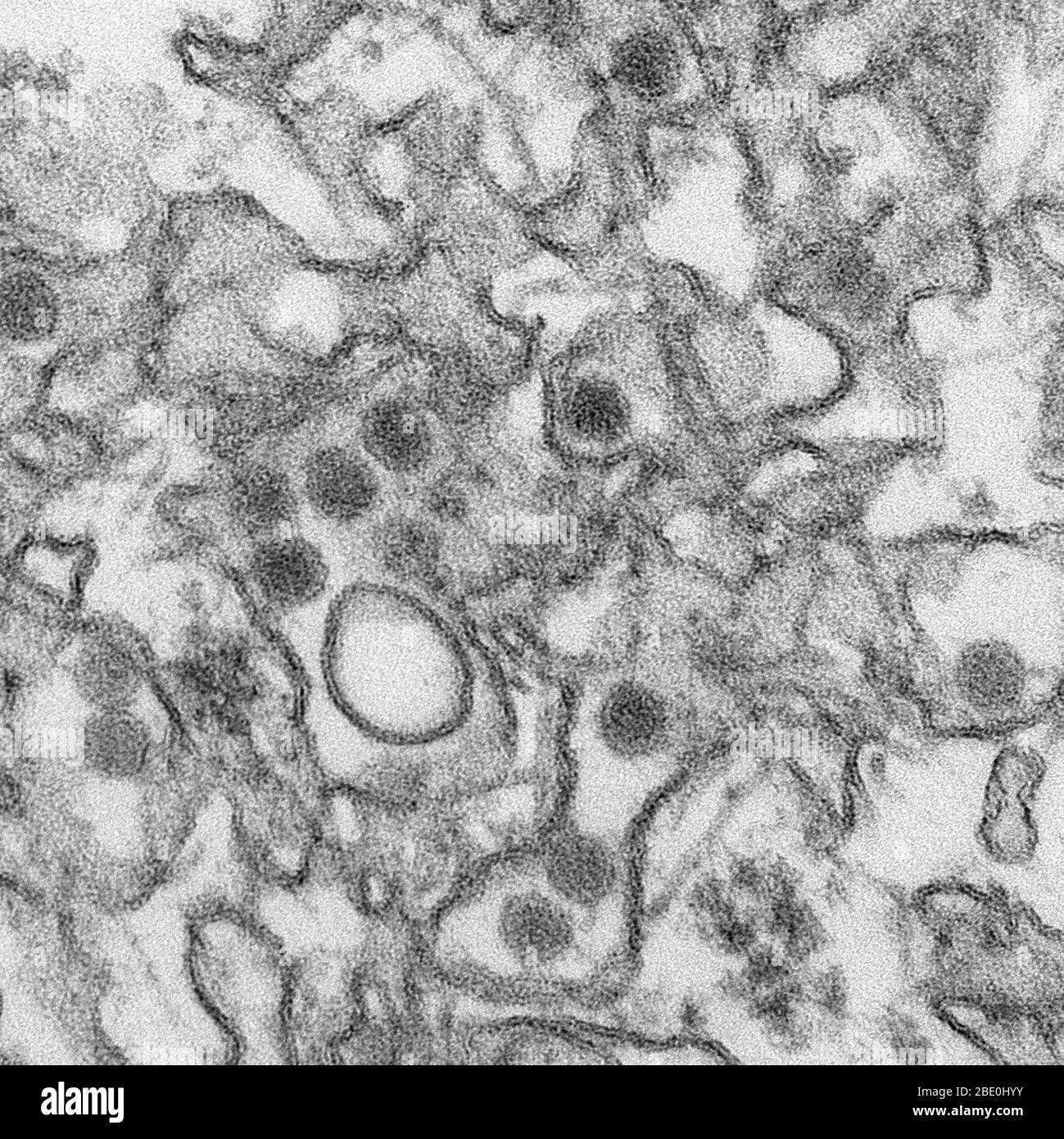 Transmission Electron Micrograph (TEM) of the Zika virus, a member of the family Flaviviridae. Virus particles are 40 nm in diameter, with an outer envelope and an inner dense core. Zika virus is spread to people through mosquito bites. The most common symptoms of Zika virus disease are fever, rash, joint paint, and conjunctivitis (red eyes). The illness is usually mild, with symptoms lasting from several days to a week. Severe disease requiring hospitalization is uncommon. Stock Photo