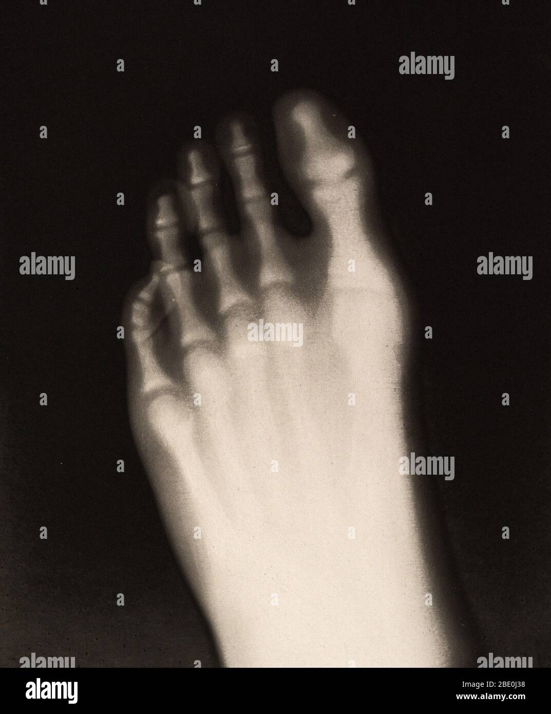 Historical X-ray of the foot of a 17-year-old boy, 1896. Taken by Josef Maria Eder (Austrian, 1855-1944) and Eduard Valenta (Austrian, 1857-1937). Photogravure. Eder was the director of an institute for graphic processes and the author of an early history of photography. With the photochemist Valenta, he produced a portfolio in January 1896, less than a month after Wilhelm Conrad Rontgen published his discovery of X-rays. Eder and Valenta's volume, from which this plate derives, demonstrated the X-ray's magical ability to reveal the hidden structure of living things. Human hands and feet, fish Stock Photo